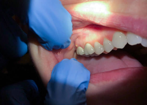 Best Pediatric Emergency Dentist in Seven Hills, OH