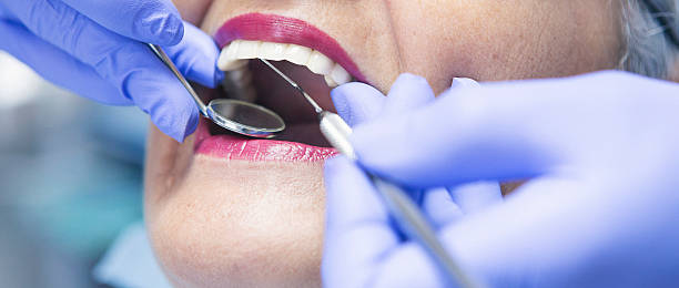Best Emergency Tooth Extraction in Seven Hills, OH